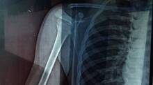 x-ray