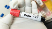 shigella-confirmed-in-thiruvananthapuram