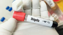 hospital-didnt-inform-about-shigella-shigella-death-victims-family-complaints
