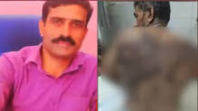 man-critically-injured-in-acid-attack-by-neighbor-in-palakkad