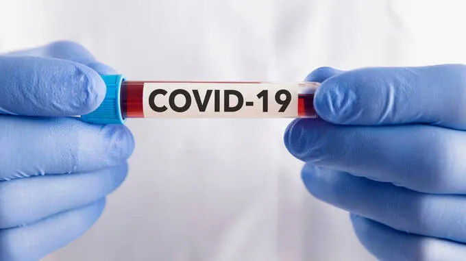covid-19