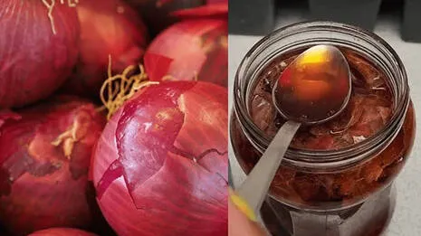 onion.1.4033212