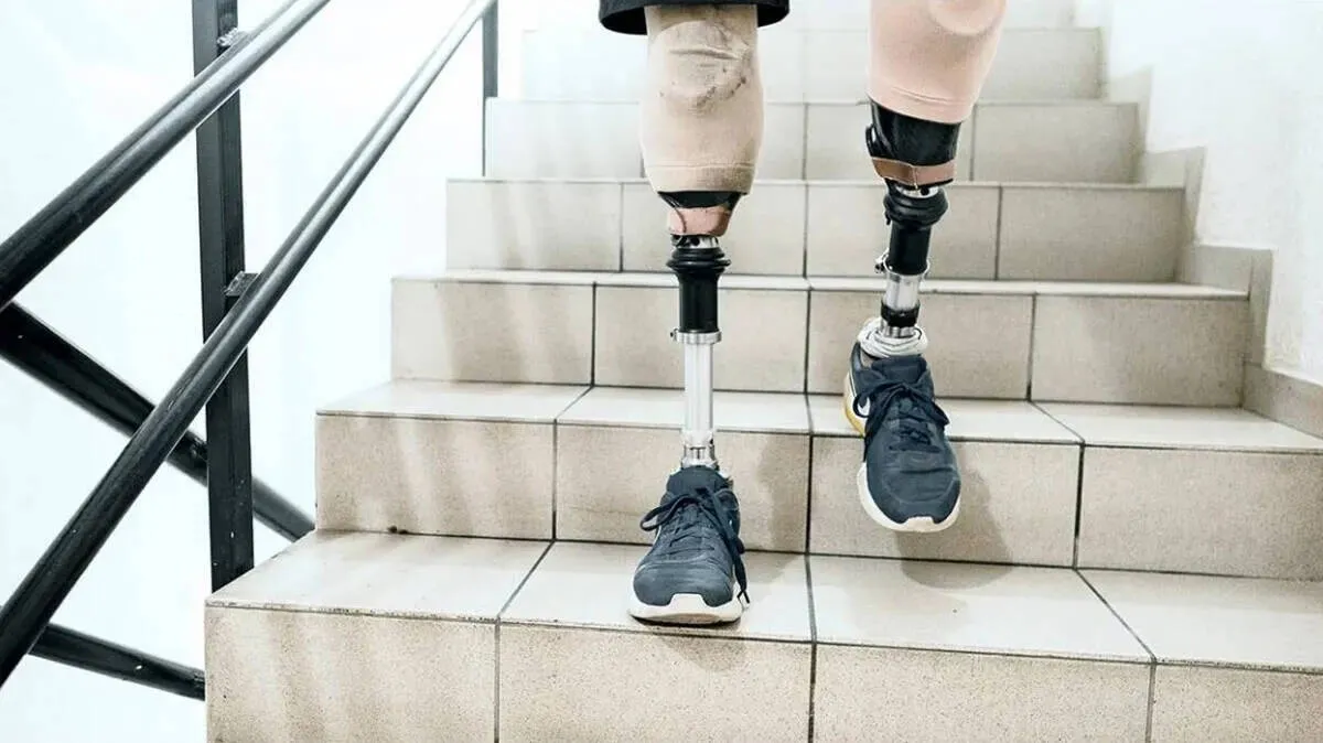 leg